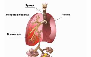 Основные признаки и симптомы пневмонии без температуры у взрослых