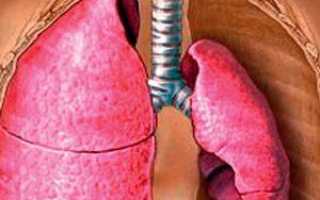 Симптомы и лечение ателектаза лёгкого