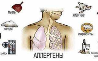 Симптомы приступа бронхиальной астмы: методы оказания помощи