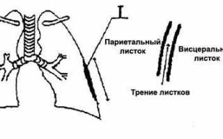 Причины сухого плеврита, симптоматика и методы терапии