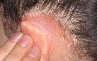 Причины неприятного запаха за ушами у детей и взрослых