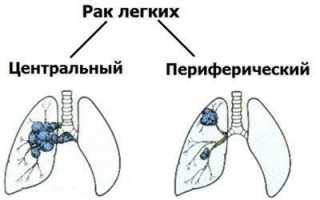 Воздействие сигарет на органы дыхания и систему кровоснабжения
