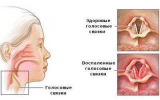 Ком в горле: вероятные причины и методы лечения