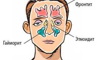 Можно ли при гайморите прогревать нос