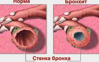 Лечение народными методами пневмосклероза легких