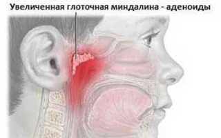 Насколько эффективен Ринофлуимуцил при лечении аденоидов у детей