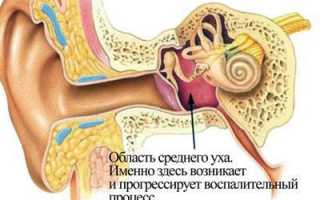 Причины шума в ушах при простудных заболеваниях