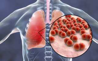 Какие осложнения может дать пневмония у взрослых