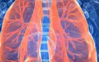 Признаки базального пневмосклероза лёгких: диагностика и лечение