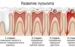 Почему при зубной боли может болеть ухо