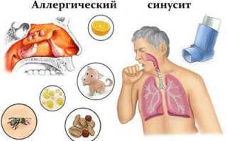 Причины и признаки хронического риносинусита, современные методы лечения