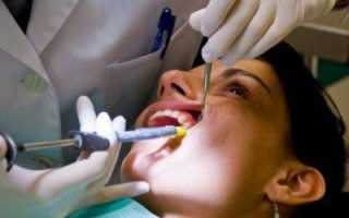 Можно ли при респираторных инфекциях лечить зубы