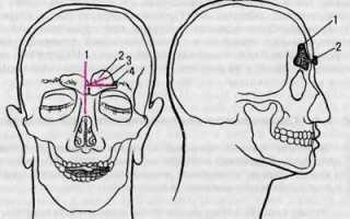 Особенности проведения трепанопункции лобной пазухи