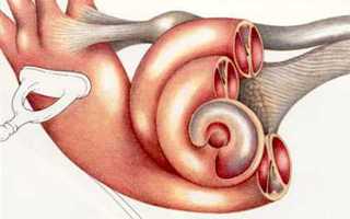 Что делать при воспалении внутреннего уха