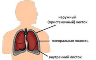 Плевральная полость и жидкость в ней: причины, симптомы, лечение патологии