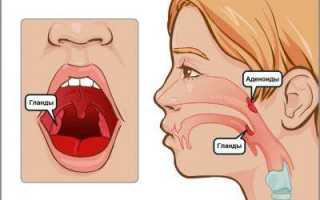Особенности лечения гнойного аденоидита у детей