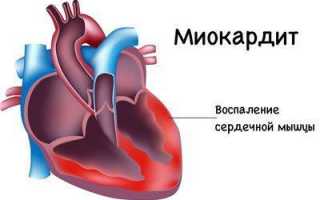 Отличие сердечного кашеля от обычного