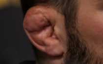 Как безболезненно сломать ухо в домашних условиях