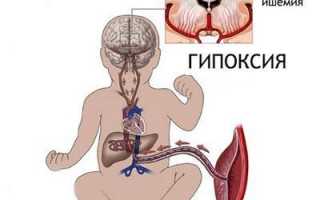 Тугоухость нейросенсорной природы: причины, симптомы, стадии