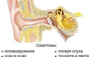 Лечение тиннитуса с учётом причин развития и симптомов патологии