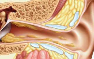 Причины образования серных пробок в ушах