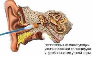 Удаление серной пробки перекисью водорода