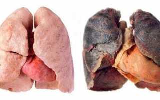 Как очистить лёгкие после курения: народные препараты и медикаменты