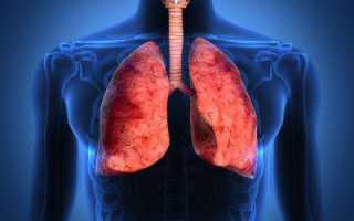 Классификация дыхательной недостаточности