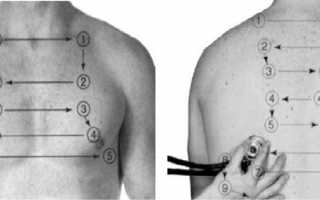 Алгоритм проведения аускультации лёгких