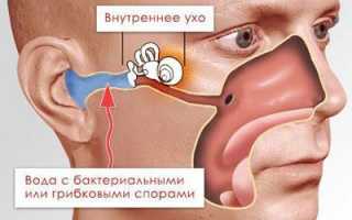 Противогрибковые капли в уши: чем вылечить грибок