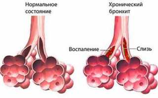 Применение Лазолвана