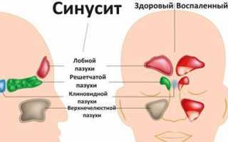 Аналоги Виброцила для лечения насморка у взрослых и детей