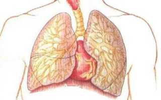 Что такое пневмосклероз легких: симптомы и лечение