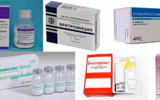 Лечение гайморита: антибиотики, промывания, ингаляции