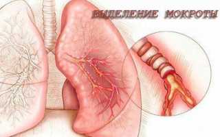 Список эффективных отхаркивающих средств при бронхите