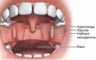 Ингаляции при аденоидах у детей
