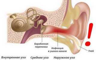 Прогревания ушей при отите