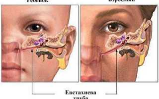 Симптомы воспаления евстахиевой трубы