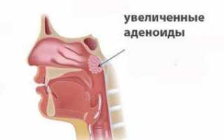 Лимфомиозот для детей при аденоидах: лечебные свойства, схемы приёма препарата