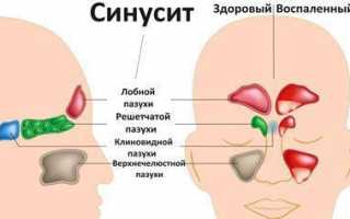 Клацид: аналоги для детей и взрослых