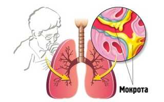 Трудноотделяемая мокрота при кашле у взрослых и детей: причины, лечение