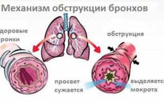 Бронхиальная астма: Комаровский